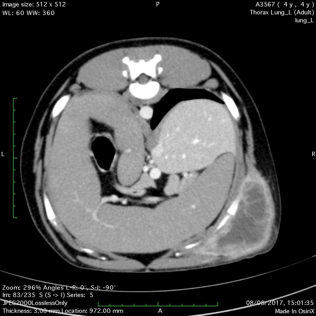 CT scan of Hector